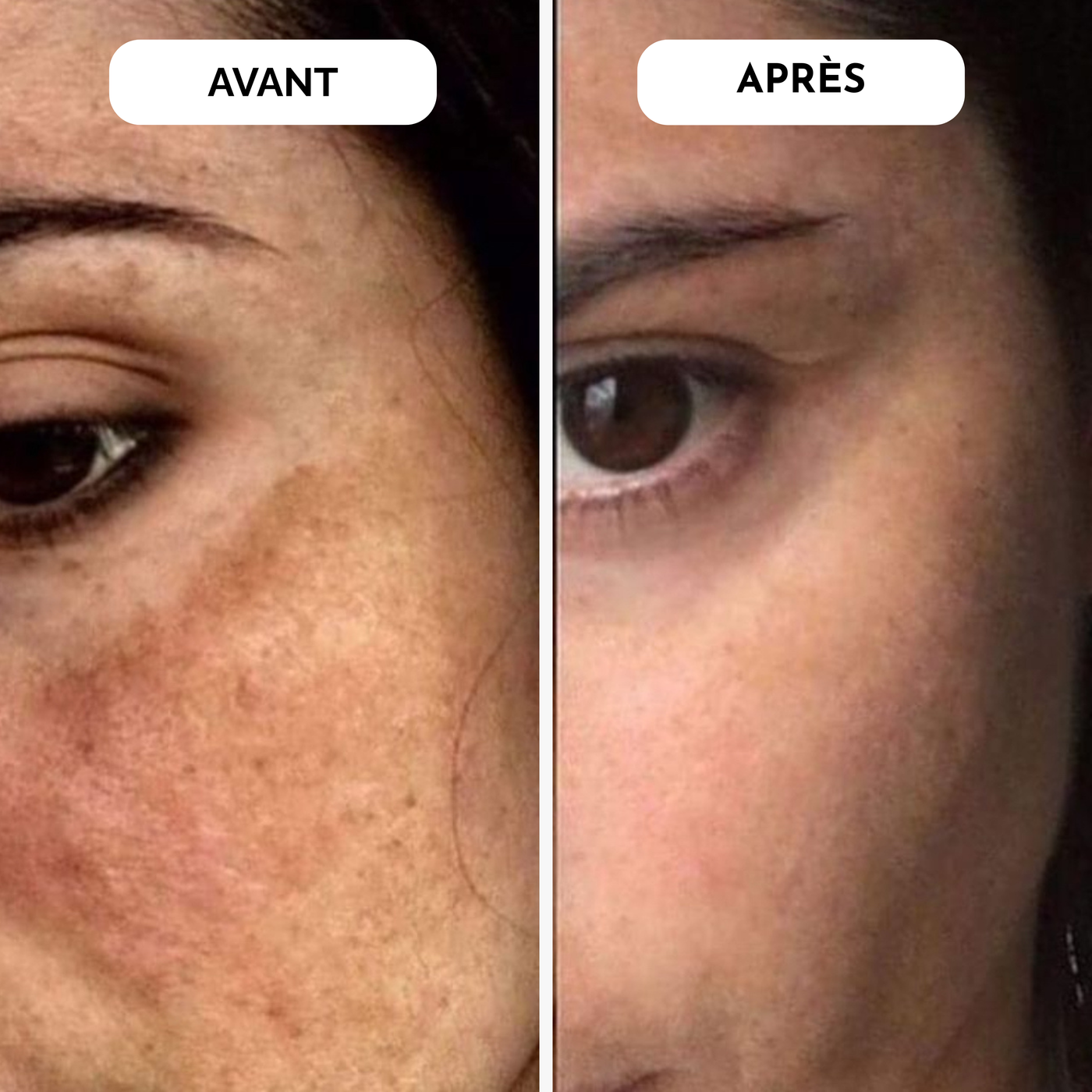 Ines, 34 ans